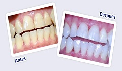 Consultorio Odontologico en Istmina