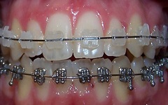 Odontologo en Istmina